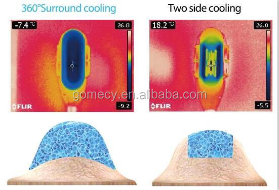 body slimming cryolipolysis comparison.jpg