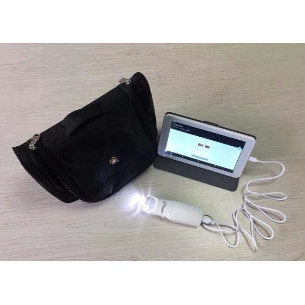 Quality PAL Color System AV Signal Digital Electronic Colposcope With TF Card And Monitor for sale