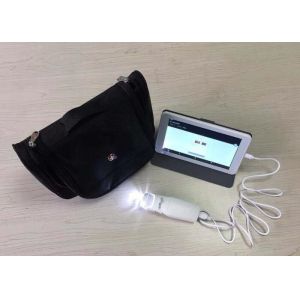 Buy cheap Pocket HD CCD Camera 100mm Colposcopy Machine from wholesalers
