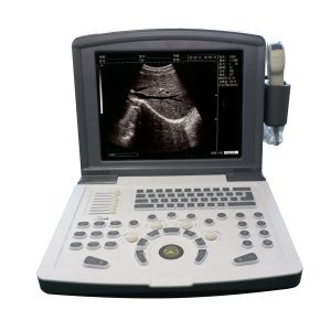Buy cheap Portable Full Digital Diagnostic Ultrasound scanner OEM product
