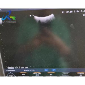 Buy cheap Aloka UST-5299 Ultrasound Transducer Probe Replace Crystal Solutions from wholesalers