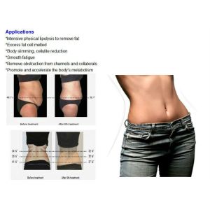 Fat Reduce Portable Diode Laser Machine Power Assisted Liposuction Machine With