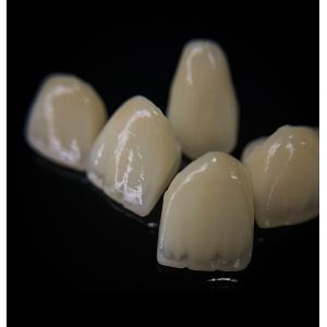 Buy cheap Comfortable Zirconia Crown With Good Fitting And Precision Esthetics from wholesalers