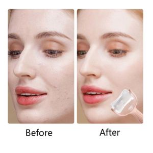 Buy cheap Silicone Cryotherapy Ice Roller from wholesalers