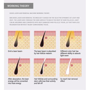 Permanent Diode Laser Hair Removal Machine Painless Device For Smoother Skin