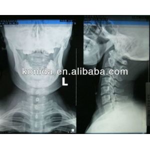 Buy cheap High Sharpness Medical Diagnostic Imaging , Dry AGFA X Ray Film from wholesalers