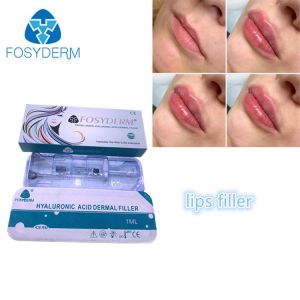 Buy cheap Filling Face Injection Fosyderm Fosyderm Hyaluronic Acid Lip Fillers 1ml from wholesalers