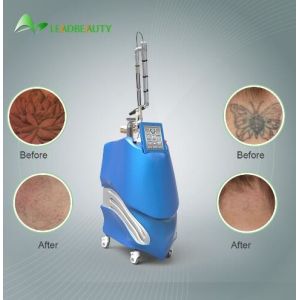 Buy cheap Birthmark removal Tattoo removal Pico second laser Nd:YAG laser product