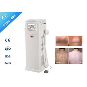 Buy cheap Fast Laser Beauty Machine 600W Laser Power , Painless Ipl Laser Machine Safe from wholesalers