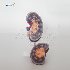Buy cheap Medical Science Human Body Anatomy Model Human Kidney Model 20x10x7CM from wholesalers