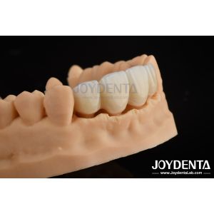 Buy cheap Biologically Oriented Preparation Technique BOPT For Accurate Dental Preparation from wholesalers