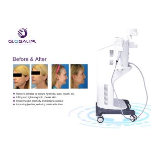 Ultrasound Face Lifting HIFU Machine 25000 Shots Self Developed Patent