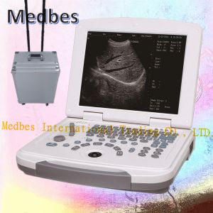 Buy cheap 2D pORTABLE Ultrasound Scanner with High Quality from wholesalers