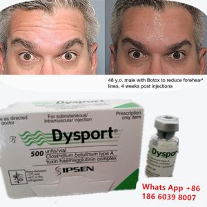 Botulinum Toxin Dysport Botox Clostridium Botulinum Type A For Eyebrow Lift