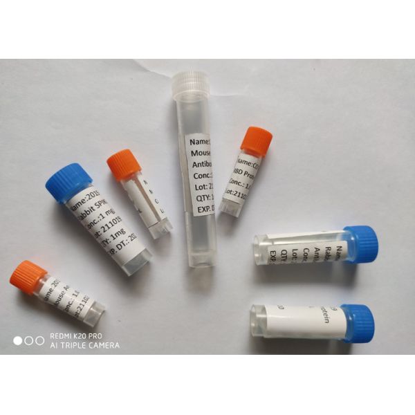 Quality Recombinant Rabbit Antibody (2019-NCoV) Spike Neutralizing Antibody, Rabbit Antibody for sale