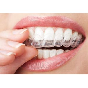 Strong Anti Pollution Ability High Technology TPU Sheets Dental Aligners