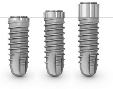 THOMMEN SPI® Implant Internal Titanium Premill Blank 10mm Engaging 3.5mm/ 4.0mm/ 4.5mm/ 5.0mm/ 6.0mm