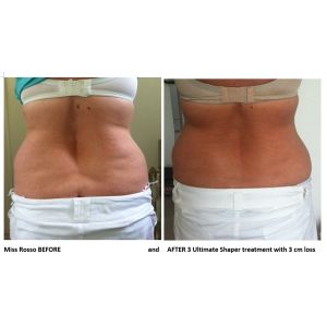 Promotion!!! Salon and spa use effective hifu body slimming machine