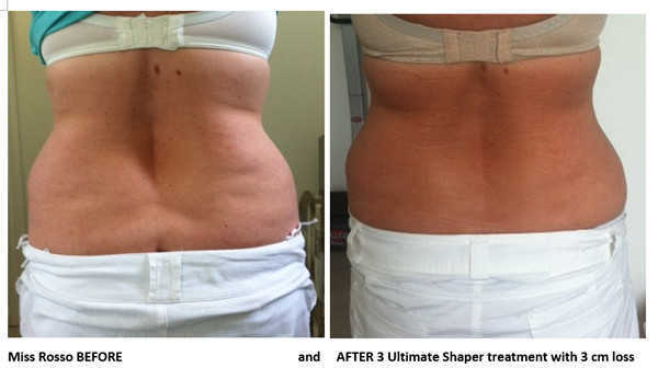 Buy cheap Promotion!!! Salon and spa use effective hifu body slimming machine from wholesalers