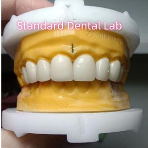 Buy cheap Ivoclar Zirconia Crown Veneers High Translucency Esthetic from wholesalers