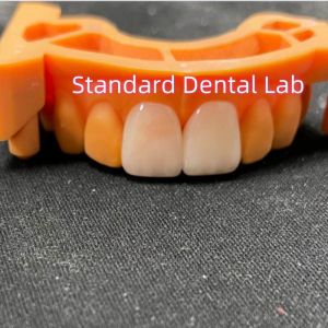 Buy cheap High Colour Stability Ivoclar Emax Laminate Veneers High Translucency from wholesalers