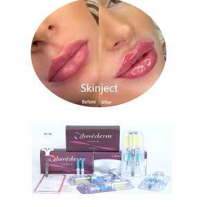 Buy cheap Juvederm Hyaluronic Acid Facial Dermal Filler Injectable 2*1ml Packing from wholesalers