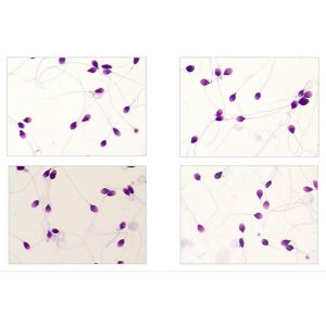 Buy cheap Ready To Use Diff Quik Stain Kit Differential Quik Stain Kit For Spermatozoa Morphology from wholesalers