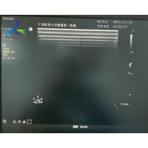 Buy cheap  Sparq Ultrasound Machine Repair Abnormal Image Replace Channel Board 453561184013 from wholesalers