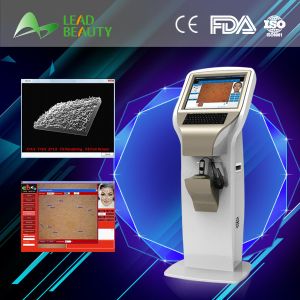 Buy cheap digital skin test equipment with CE FCC ROHS certificate from wholesalers