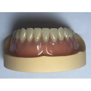 Easy To Clean Full Acrylic Denture Highly Elastic for long term use