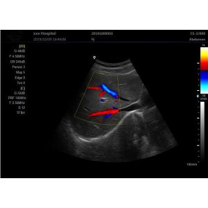 Portable Ultrasound Device Portable Ultrasound Scanner Color Doppler with 2 USB