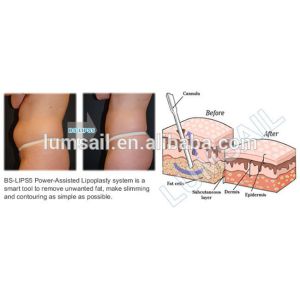 Power Assisted Liposuction Machine Intervention therapy fat suction