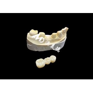 High-Hardness Aesthetic Zirconia Dental Crown with Translucency and Chipping