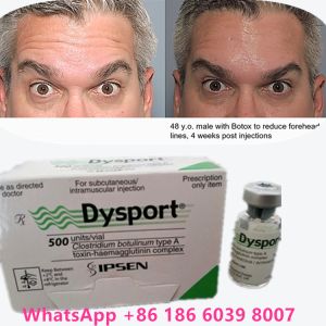 Buy cheap Botulinum Toxin Type A 100 Units Dysport For Removing Use from wholesalers