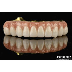 Buy cheap Titanium And Zirconia Comfort Comfortable To Wear Ti-Bar Zirconia Hybrid Bridge For Replacement Of Missing Teeth from wholesalers