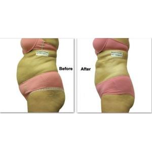 Buy cheap 2019 Latest Cryolipolysis Body Slimming Fat Removal Laser from wholesalers