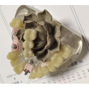 Buy cheap 100 Percent Biocompatibility PMMA Provisional Crown from wholesalers