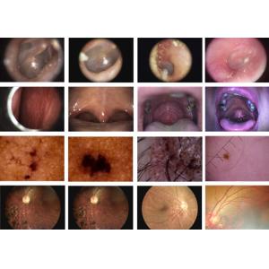 Handheld Digital Video Otoscope Dermatoscope Ophthalmoscope With High Resolution