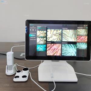 Customizable Scalp Analysis Machine For Dryness And Dandruff Problem