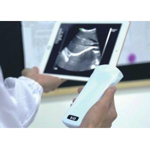 Wireless Ultrasound Probes Handheld Ultrasound Device With B, B/M, Color Doppler