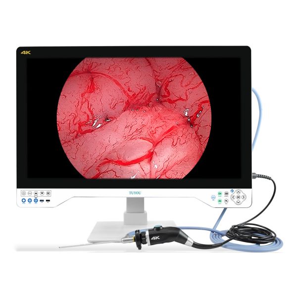 Buy cheap Revolutionize Your Medical Practice with 4K 32 Inches Endoscope Camera System for Enhanced Imaging from wholesalers