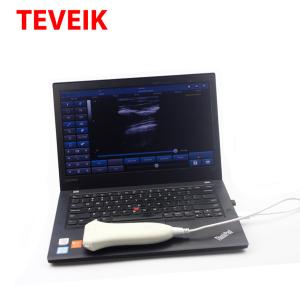 Buy cheap Medical Ultrasound Instruments USB Protbble Ultrasound Linear Probe from wholesalers