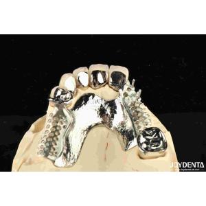 Buy cheap Alloying Metal Dental Framework Removable Wearable For Dental Practitioners product