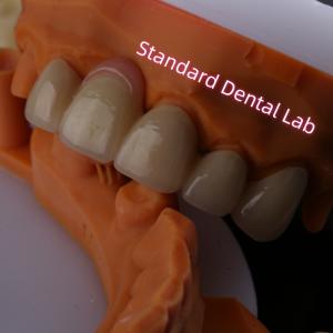 Buy cheap Highly Biocompatible PFZ Porcelain Layered Zirconia With Pink Gum from wholesalers